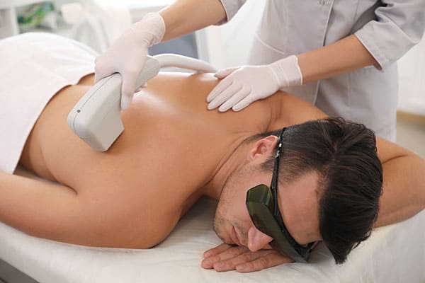 Laser Hair Removal for Men