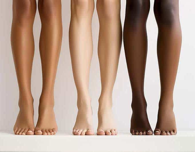 legs laser hair removal