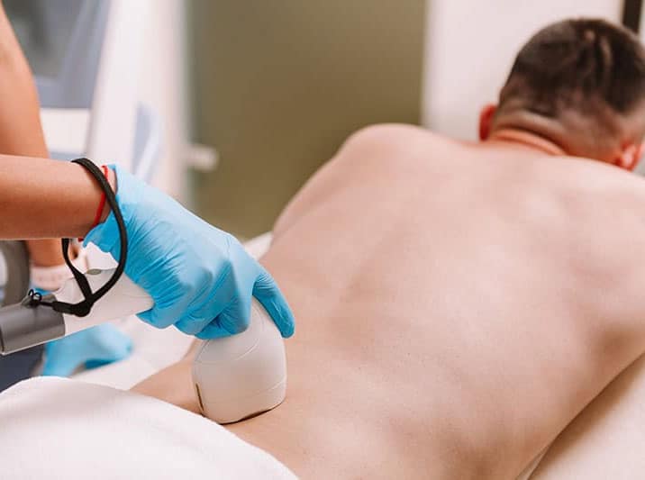male full body laser hair removal