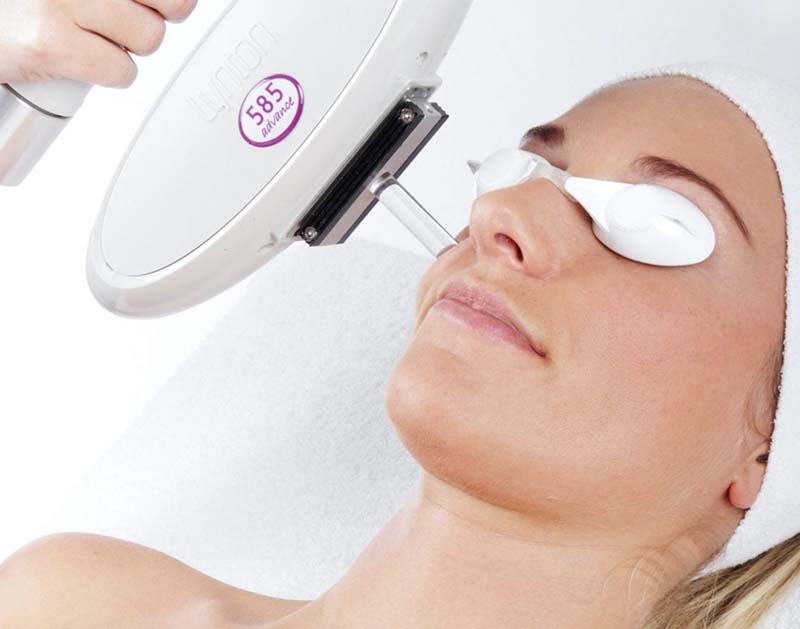 sun damage treatment